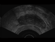Original Ultrasound