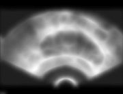 After Pre-Processing