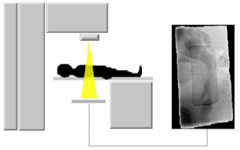 Radiotherapy